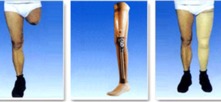 下肢假肢 $23$3.png