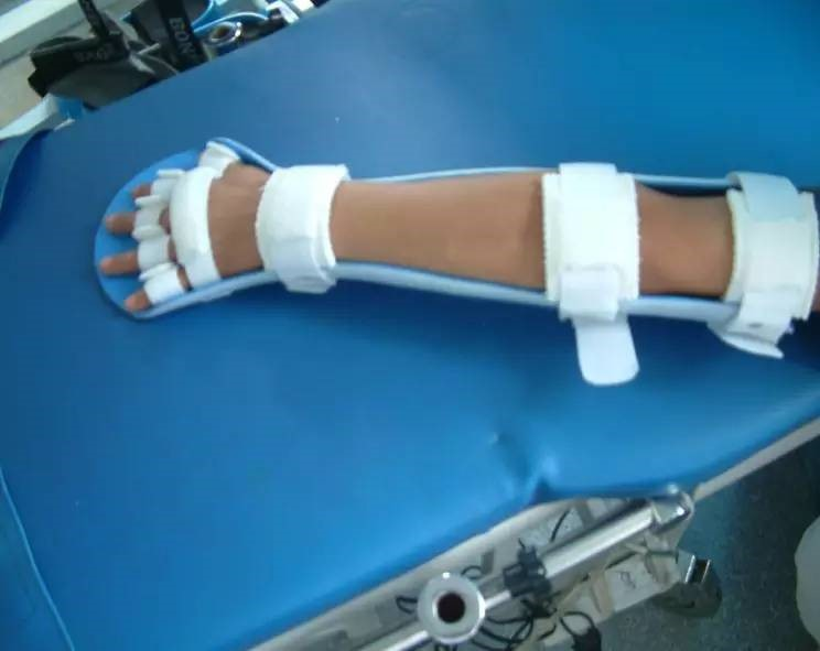 肘腕手矫形器.png